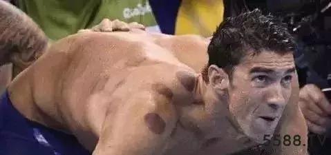 这些人群不适合去刮痧、拔罐、推拿,看看有没有你